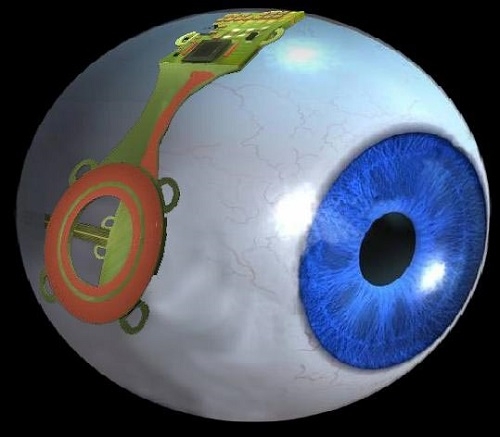 Биометрические линзы сделают зрение в три раза острее