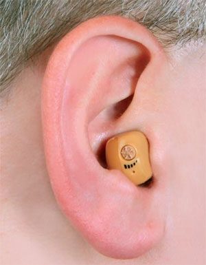 Voice Clarifying Amplifier Voice Clarifying Amplifier