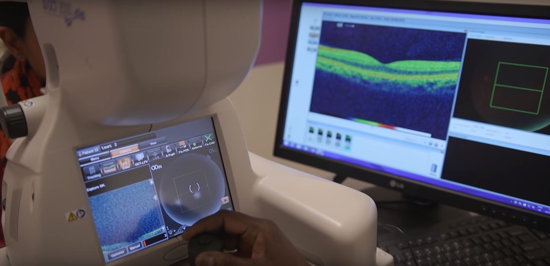 ИИ-система DeepMind способна диагностировать более 50 глазных болезней