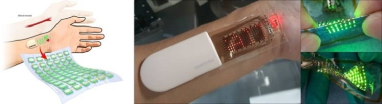 Samsung разрабатывает эластичные дисплеи для медицинского применения