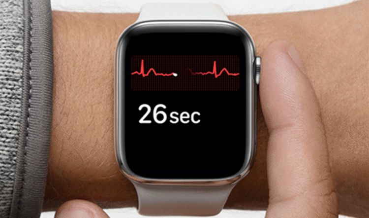 Часы Apple Watch научатся измерять артериальное давление и температуру тела