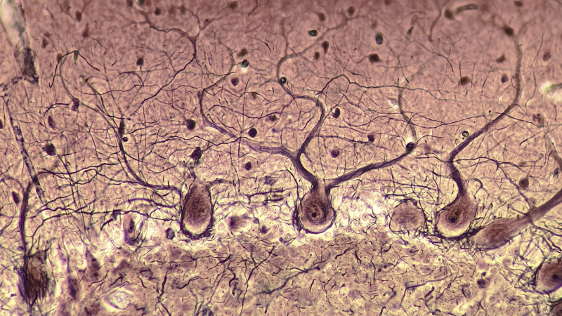  Микрофотография открытых Яном Пуркинье (Jan Purkyně) в 1839 г. «ганглиозных телец»: расположенных в мозжечке крупных нейронов с чрезвычайно разветвлёнными дендритами (источник: Wikimedia Commons) 