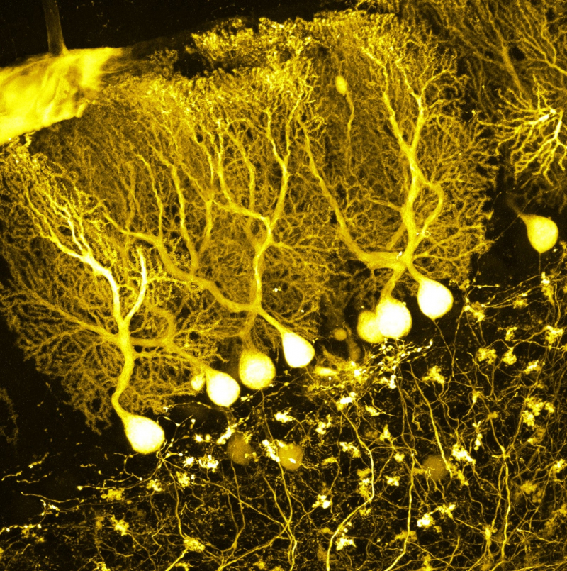  Для нейрофизиолога знание о том, что нейроны в мозге соединяются каскадами, тривиально, — но инженерам на постижение этой истины потребовался немалый срок (источник: Wikimedia Commons) 
