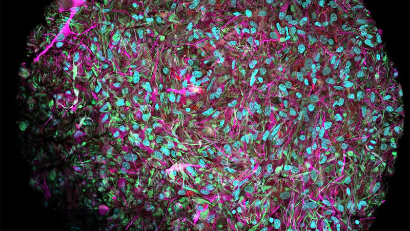  Органоид мозга (нейроны показаны фиолетовым, я ядра клеток — синим). Источник изображения: Jesse Plotkin/Johns Hopkins University 
