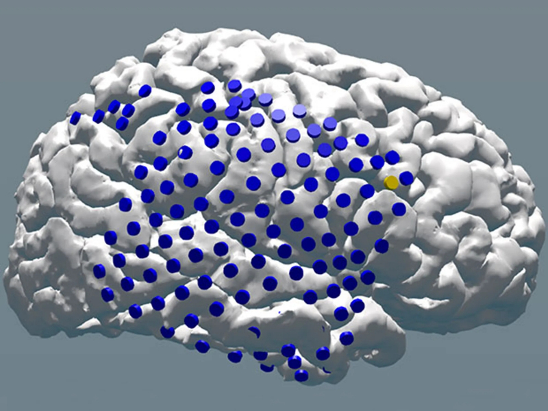 Схема одного из полушарий «обобщённого мозга», исследованного в Computational Memory Lab при помощи системы машинного обучения, с указанными точками входа всей совокупности электродов (источник: University of Pennsylvania) 