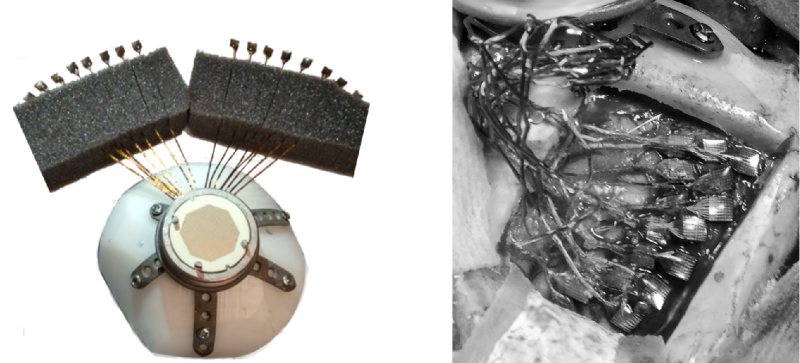  Титановый держатель массива электродов (слева) монтировался на голову подопытной обезьяны, тогда как сама электродная сетка (справа) для генерации фосфенов накладывалась на зрительную зону коры (источник: Science) 