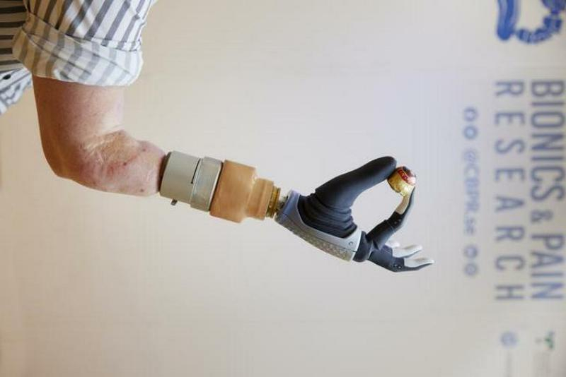 Рука помощи: как устроен бионический протез