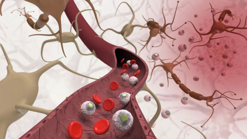 В MIT придумали чипирование без хирургии — имплант доберётся в мозг верхом на иммунных клетках - похожая новость на Toplenta